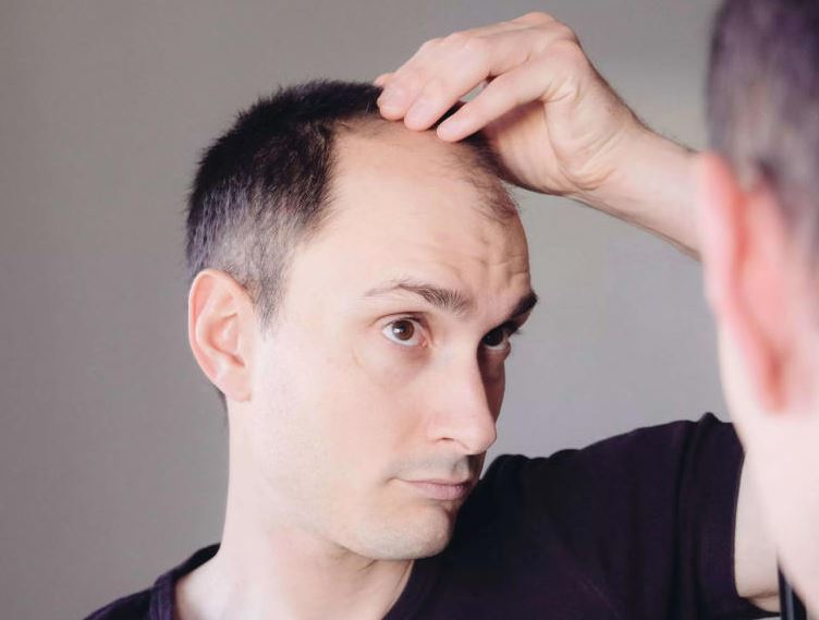 4 lifestyle changes men can make now to prevent early hair loss, according to a dermatologist