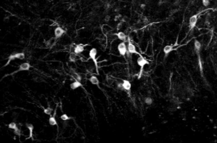 Human Brain Cells Grow in Rats, and Feel What the Rats Feel