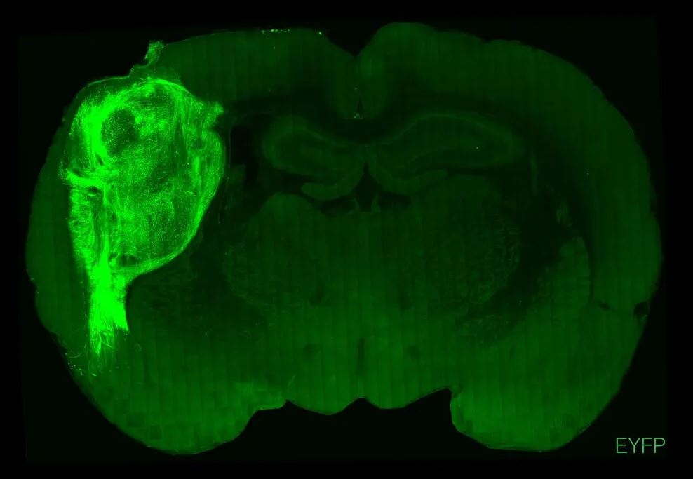 It is Possible for Human Brain Cells to Grow in Rats, and Humans Can Experience What Rats Feel