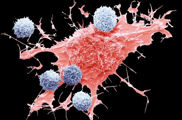 Innovative Cancer Treatment May Sometimes Cause Cancer, F.D.A. Says